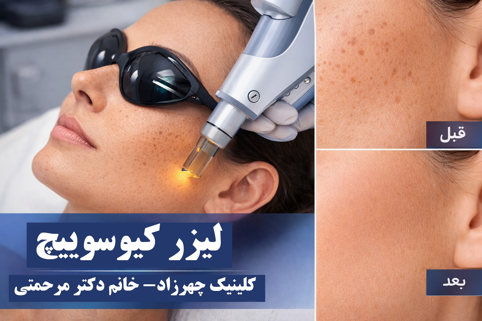 لیزر کیوسوییچ کلینیک چهرزاد